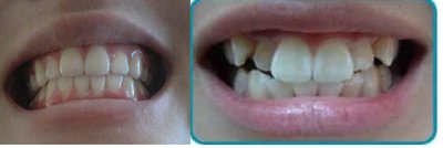 Энэ шүү дээ.